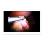 8MP Surgical Monitor